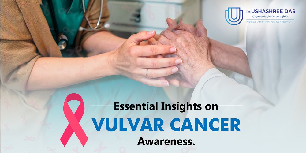 What You Should Know About Vulvar Cancer?
