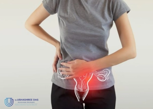 Early Ovarian Cancer Symptoms That Don’t Feel Like Cancer